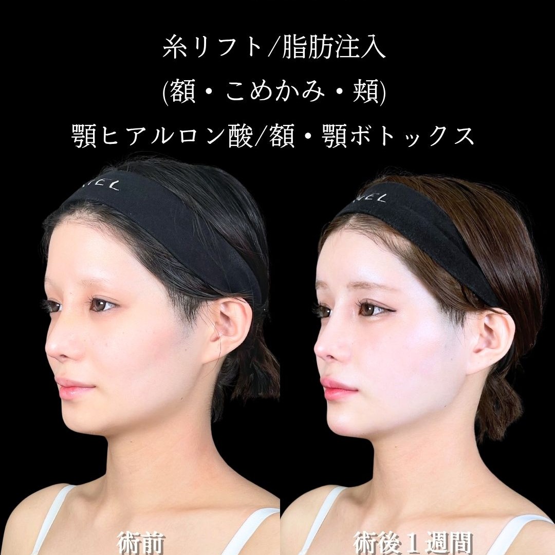 No.16735の症例写真2